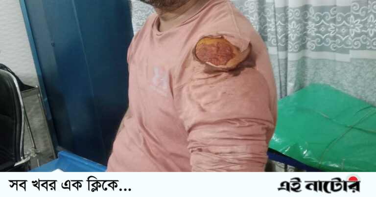 বাগাতিপাড়ায় নির্বাচনি সহিংসতায় জামায়াত কর্মী গুরুতর আহত