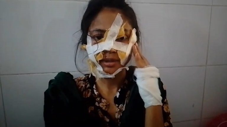 ডিভোর্স দেয়ায় গৃহবধূকে ব্লেড দিয়ে শরীরে বিভিন্ন স্থানে আঘাতের অভিযোগ সাবেক স্বামীর বিরুদ্ধে